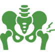 5_Hip 1